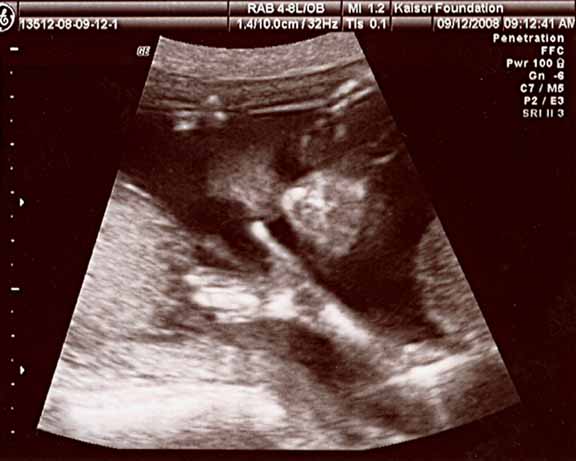 brayer baby hello sonogram.jpg